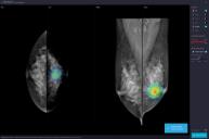 루닛에서 제공 중인 서비스. (출처: 중기부)
