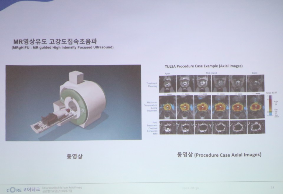 코어테크 MR 영상유도 고강도집속초음파. (사진=스타트업투데이)
