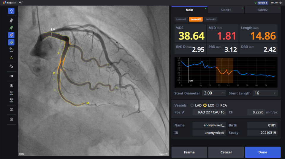 메디픽셀의 ‘MPXA’(사진=메디픽셀)