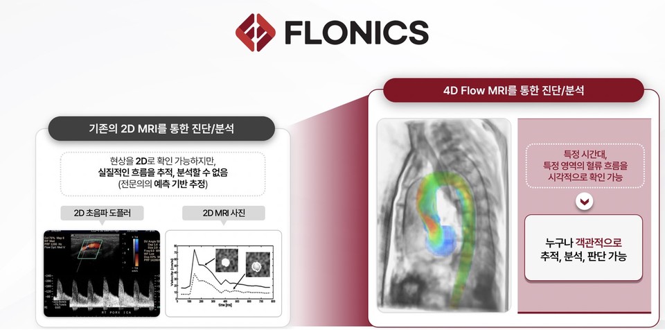4D Flow MRI (사진=플로우닉스)
